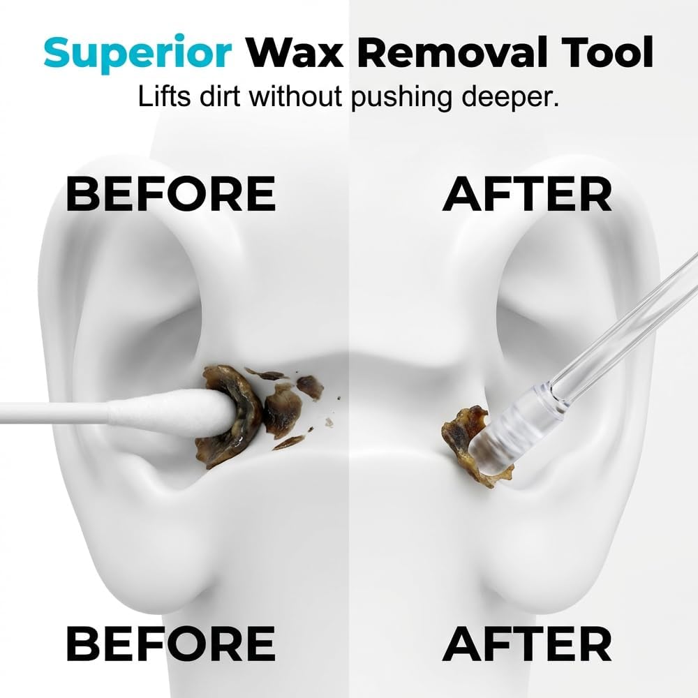 Sticky Ear Cleaner - Reusable Ear Wax Removal Tool with Soft Adhesive Tips, Gentle Ear Cleaning for Adults